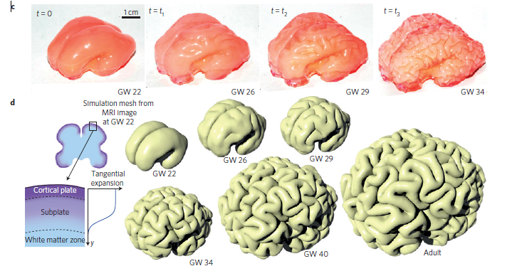 Evolution du modèle mécanique du cerveau et comparaison avec la réalité. 