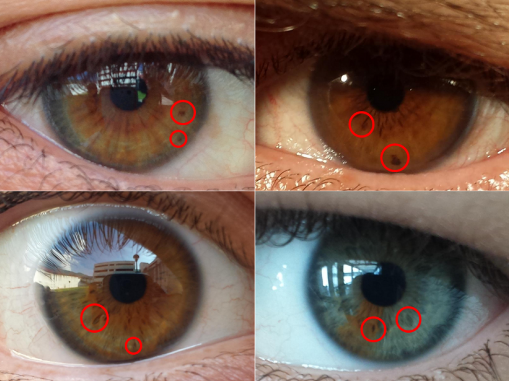 oeil, spot, biométrie