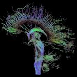 Neural Meta Tracts, brain, white matter, Pietro Gori