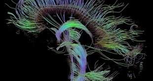 Neural Meta Tracts, brain, white matter, Pietro Gori