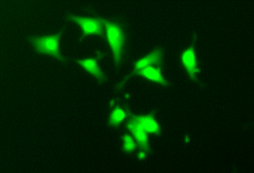 Cellules de glioblastome, marquées par fluorescence. 