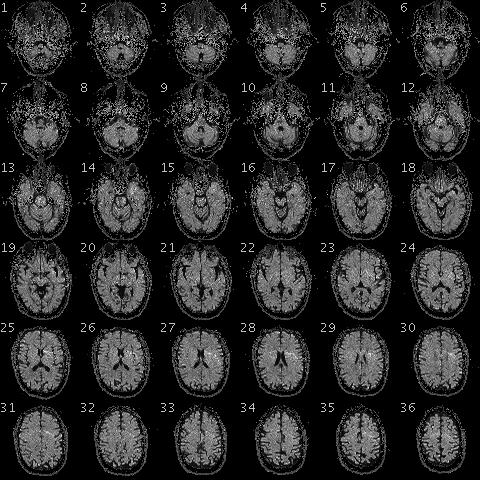 L'IRMf produit des images de coupe du cerveau avec une bonne résolution spatiale, mais une mauvaise résolution temporelle. 