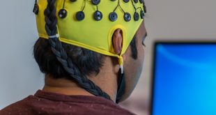 Electroencephalogram: a brain imaging technique that is efficient but limited in terms of spatial resolution.
