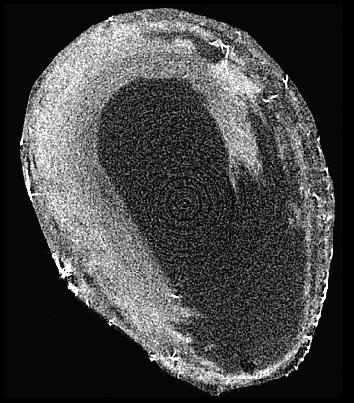 Reproduction in vitro d'une dissection aortique pour l'étude de la rupture d'un anévrisme. Ici, l'image est réalisée par tomographie à rayons X sur une artère de lapin.